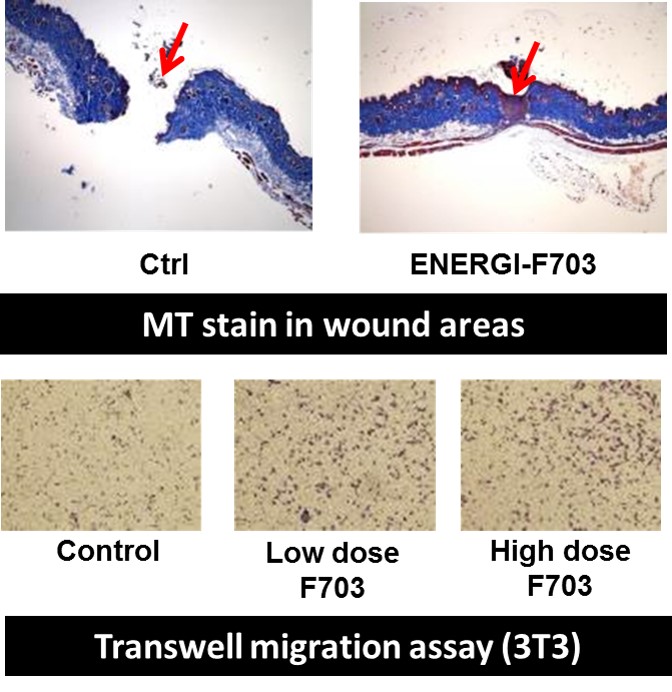 Figure 1. ENERGI-F703 enhances the migration of fibroblast cells in the in vitro wound healing experiments.